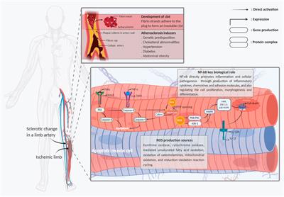 Stem Cell Therapy in Limb Ischemia: State-of-Art, Perspective, and Possible Impacts of Endometrial-Derived Stem Cells